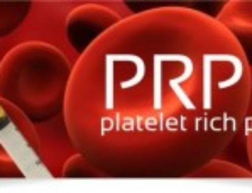 FAQs on Platelet Rich Plasma Therapy from a Beverly Hills Orthopedic